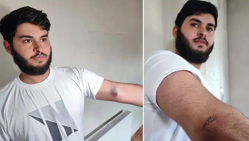 Mahallede Top Kavgası: Conolar Kamyonetle Geldi!